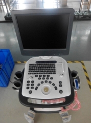 MY-A021 NUEVA máquina de ultrasonido móvil con sistema de diagnóstico ultrasónico B/W con carro completamente digital