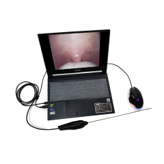 MY-P008M professional Medical Portable electronic ENT endoscope (en inglés)