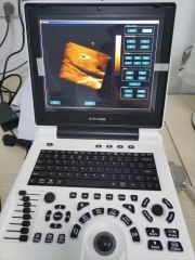 MY-A024N portátil de 12pulgadas con escáner de ultrasonido Doppler a color