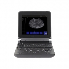 Profesional médico MY-A007C portátil portátil BW ultrasonido Scanner