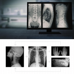 Sistema de fotografía digital de techo del hospital my - d048a Dr
