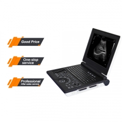 My - a024a - N ultrasonido portátil de examen físico de sonda de ultrasonido rectal humano de color